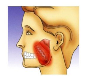 Craniomandibuläre Dysfunktion