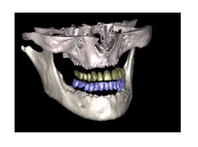 3D-CT