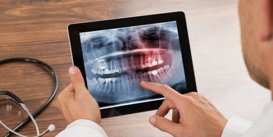 zahnarztangst narkose funktionsdiagnostik sensitive dentists